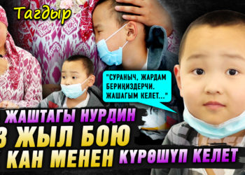 «Жашагым келет…» | 4 жаштагы Нурдин 3 жыл бою ак кан менен күрөшүп келет