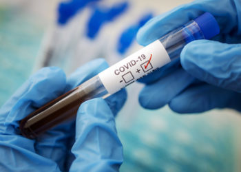 Бир суткада 128 адамдан коронавирус аныкталды. Анын 116сы Бишкектен