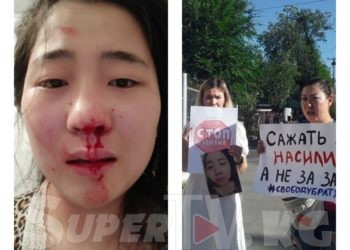 Күйөөсүнөн зомбулук көргөн аял. «Агам мени коргойм деп камалып, мени сабаган күйөөм эркиндикте жүрөт» дейт ал (фото)