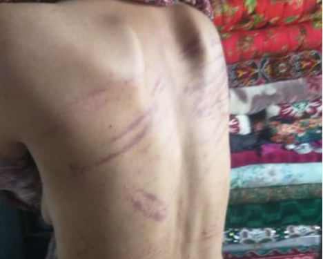 Чүйдө келин күйөөсү тарабынан сабалганын айтып, милицияга арыз жазды