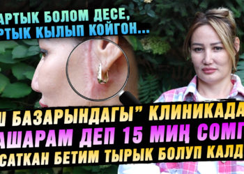 “Ош базарындагы» клиникадан 15000 сомго жасаткан бетим тырык болуп калды» дейт 33 жаштагы келин