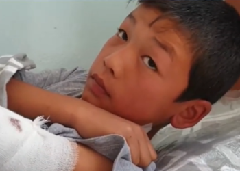 Кыргыз-тажик чек арасындагы атышууда жаракат алган бала: «Кошунабызга суу ташып жардам берип жаткам»