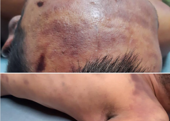 Оштогу түрмөдө көз жумган жаран. Анын жакындары денесинен көгала тактарды көрүшкөнүн айтты