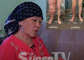 «Видеодон кийин түшкөн акчага операция жасаттым» дейт бир буту 20 килограмм болгон SuperTV’нын каарманы