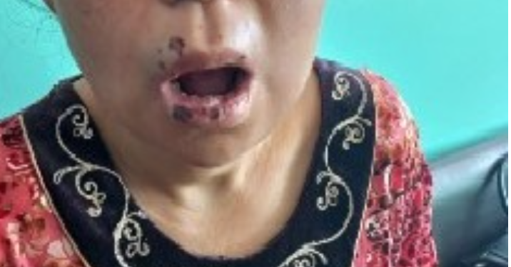 «Мойнумдан өйдө соо жерим жок». Оштогу психиатрия борборунда аял киши сабалганы маалымдалды