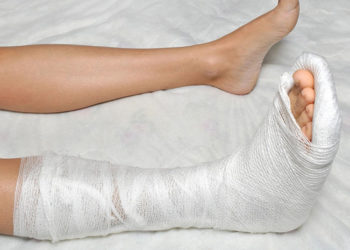 ГУМдагы эскалатордон кулап кеткен жигиттин буту сынган