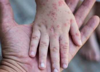 Маймыл чечегинин аталышы өзгөртүлөт