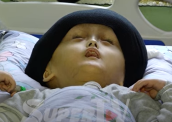 «Уулумду көчөдө көргөндөр таң калып карашат» дейт чанда кезикчү ооруга чалдыккан баланын апасы