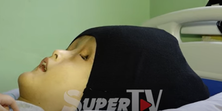 «Күйөөм менен 2 жыл мурда ажырашкам. Азыр бизге каралашпайт» дейт чанда кезикчү ооруга чалдыккан баланын апасы