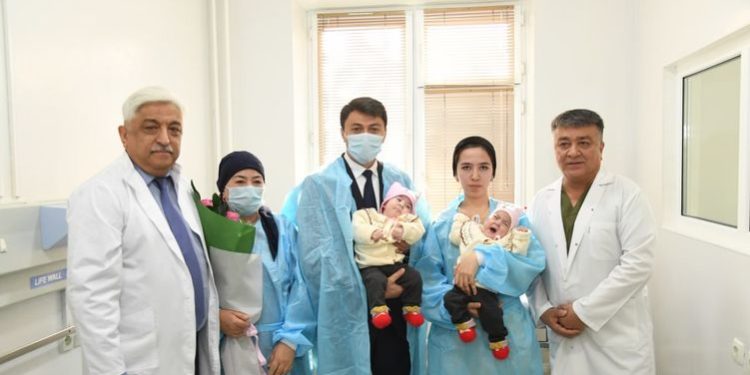 Өзбекстанда дарыгерлер кыргызстандык сиам эгиздерин ажыратышты