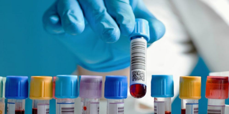 Орусияда мигранттарды кошумча медтекшерүүдө акы алынбай турган болду