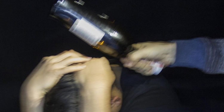 Орусияда бөтөлкө менен сабалган кыргызстандык ооруканада көз жумду