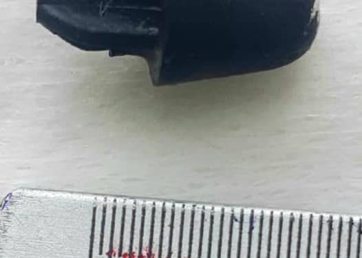 Бишкекте 5 жаштагы баланын сол өпкөсүнө оюнчуктун сыныгы кирип кеткен (сүрөт)