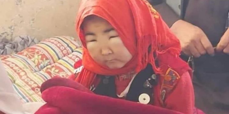 «Бир бөйрөгү жарабай калган». 10 жаштагы памирлик кыргыз операцияга муктаж болуп жатат