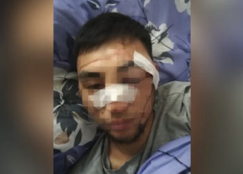 Депутат катышкан мушташ. Жабырлануучунун абалы айтылды