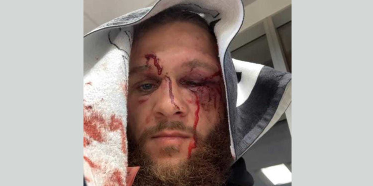 Рафаэль Физиев утулуп калган беттештен кийинки сүрөтүн жарыялады