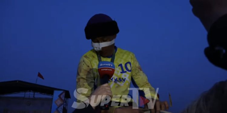 “Өтө деле оор жаракат эмес, аттын тиши тийип кетти” деди жаракат алган көк бөрүчү