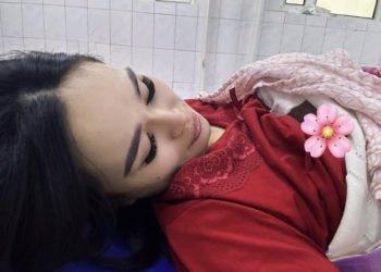 Модель Эркеайым Абдуллаева көз жарды