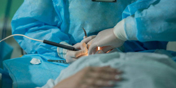 Казакстанда көзүнө сурма чыгарткан аял көз жумду