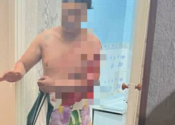 Бишкекте эркек киши өзүнүн өмүрүнө кол салууга аракет кылды