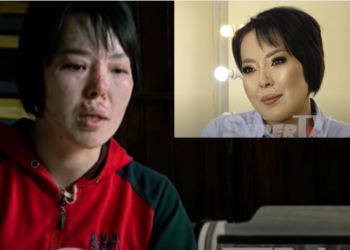 «Газ жарылып, күйүп калган соң, жолдошум жакын адамым менен жүрүп кетти» деген келин таанылгыс болуп өзгөрдү