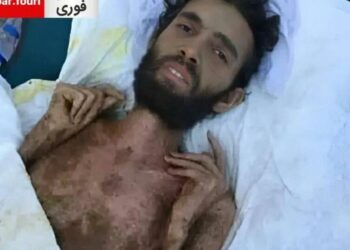 Сириядагы жер титирөөдөн 3 айдан кийин урандыдан аман калган жаран чыгарылды