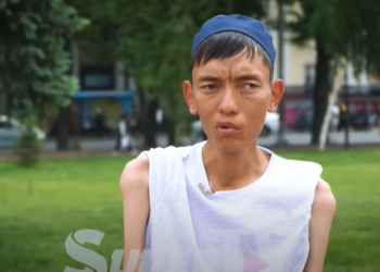 35 килограмм болгон 29 жаштагы жигит: «Келинчегим жуунтат, кийинтет. Мен ага ыраазымын»