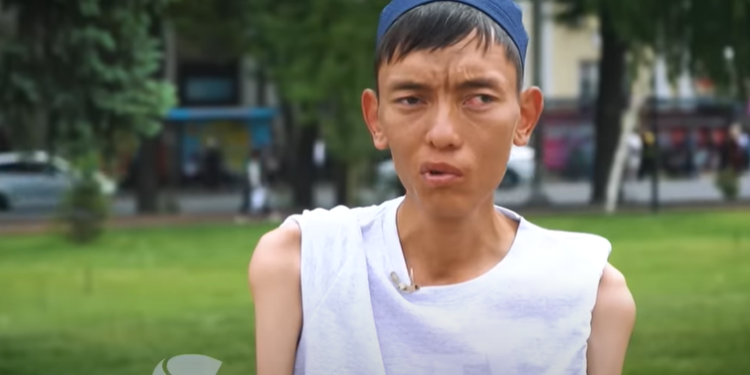 35 килограмм болгон 29 жаштагы жигит: «Келинчегим жуунтат, кийинтет. Мен ага ыраазымын»