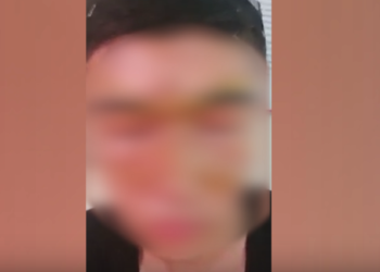 «Сузактагы мектепте салют окуучунун бетине атылып кеткен» деген видео тарады