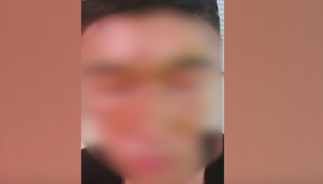 «Сузактагы мектепте салют окуучунун бетине атылып кеткен» деген видео тарады