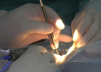 Кытай дарыгерлери Бишкекте жана Ошто 600 адамдын көзүнө бекер операция жасайт