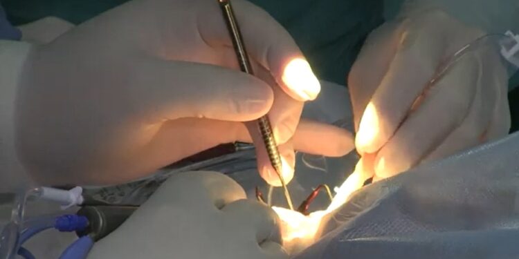 Кытай дарыгерлери Бишкекте жана Ошто 600 адамдын көзүнө бекер операция жасайт