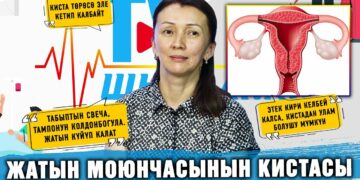 Кистаны операция жолу менен улам алдырса, эмне болот? Гинеколог жооп берет