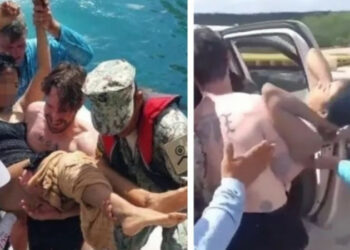 «5 жолу операция жасалды». Америкалык медайымга акула кол салды