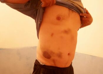 «Башына уксус куюлган баштык кийгизип». Чүйдө жарандар милицияда 5 саат кыйнашканын айтып чыгышты