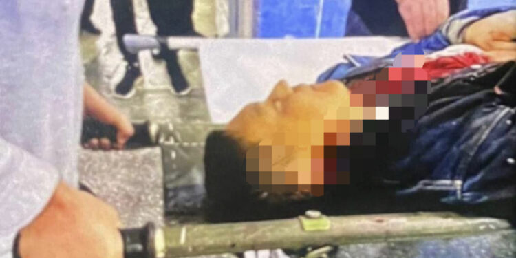 Маркум Камчы Көлбаевдин сөөгү делген сүрөт жарыяланды