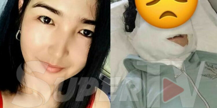 Кулак-мурду кескиленген келиндин жактоочулары Башкы прокуратурага кайрылышты