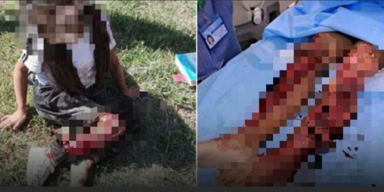 Интернетте кичинекей кыздын үрөй учурган сүрөттөрү тарады. Милиция окуя Кыргызстанда болбогонун билдирди