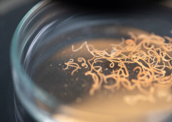 Кытайда аялдын көзүнөн 60 курт алынды