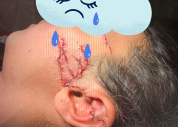 «Кулагы кесилген кыз, колу кесилген бала». Оштогу балдар ооруканасы ата-энелерге чукул кайрылуу жасады