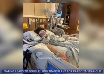 АКШда электрондук тамекини «жакшы» көргөн жигит эки өпкөсүн тең алмаштырды