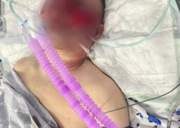 «Иним өлүм төшөгүндө жатат» деген сабалган жарандын бир тууганы УКМК төрагасына кайрылды