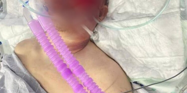 «Иним өлүм төшөгүндө жатат» деген сабалган жарандын бир тууганы УКМК төрагасына кайрылды