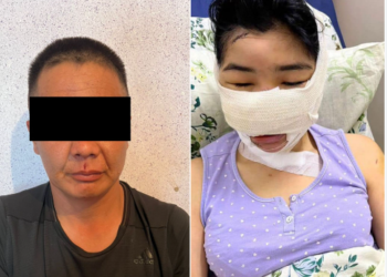 Селекцияда мурдагы жубайынын кулак-мурдун кескилеген шектүү аталык укуктан ажыратылды