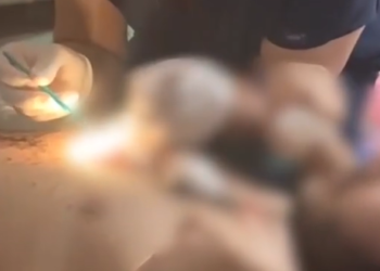 «Операцияны үйдө жасашкан». Чүйдө адам өлтүрүүгө аракет кылган шектүүлөр кармалды