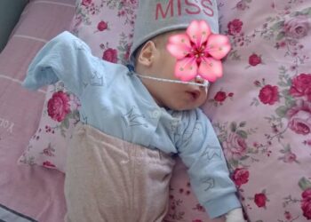 Колу чыканагынан ылдый кесилген наристенин бүгүнкү абалы кандай болуп калды?