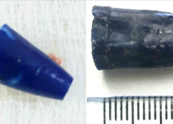 Бишкектеги ооруканага 15 күндүн ичинде 3 бала калем саптын башын жутуп түшкөн