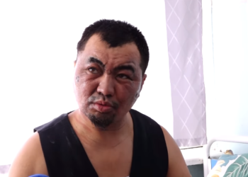 Бишкек ЖЭБдеги кырсыкта жабыркаган жаран окуя тууралуу айтып берди