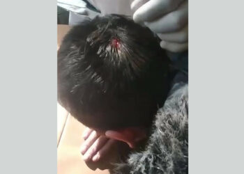 Өзбекстанда мугалим телефон менен окуучунун башын жарган (видео)