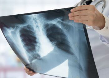 Бишкектеги №67 мектептин окуучусунан кургак учук аныкталды